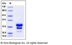 Sino Biological Recombinant Human CLEC4D Protein (His Tag), HPLC-verified,