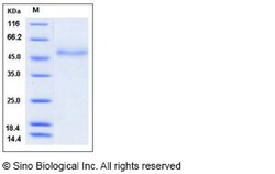 Sino Biological Recombinant Human Factor VII Protein (His Tag), HPLC-verified,