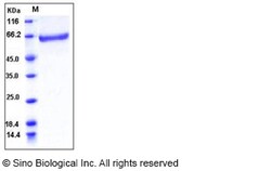 Sino Biological Recombinant Human Factor XIII Protein (His Tag), HPLC-verified,