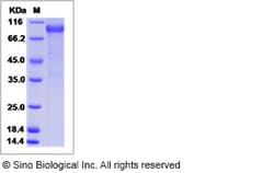 Sino Biological Recombinant Human Fibromodulin Protein (hFc Tag), Quantity: