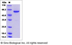 Sino Biological Recombinant Human PTPN9 Protein (His & GST Tag), Quantity: