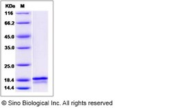 Sino Biological Recombinant Human FGF6 Protein, Quantity: Each of 1