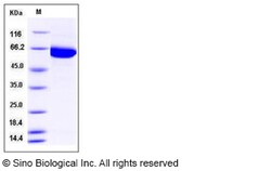 Sino Biological Recombinant Human PAK3 Protein (His Tag), Quantity: Each