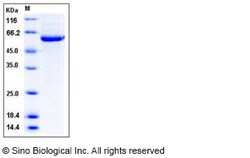 Sino Biological Recombinant Human MST1 Protein (His Tag), Quantity: Each