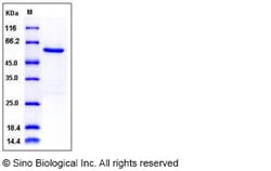 Sino Biological Recombinant Human NEK7 Protein (His & GST Tag), Quantity: