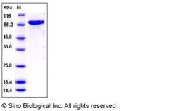 Sino Biological Recombinant Human CDC42BPB Protein (His & GST Tag), Quantity: