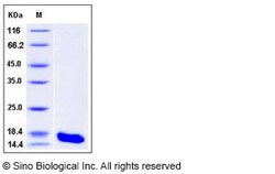 Sino Biological Recombinant Human Cystatin S Protein (His Tag), HPLC-verified,