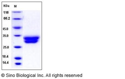 Sino Biological Human VSIG2 / CTXL Protein (His Tag) 100ug, Quantity: Each