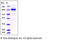 Sino Biological Human TAOK3 / JIK / MAP3K18 Protein (aa 1-411, His & GST