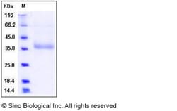 Sino Biological Human NCR2 / NKp44 / CD336 Protein (His Tag) 100ug, Quantity: