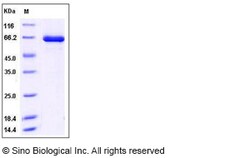 Sino Biological Human TLK2 / PKU-ALPHA Protein (aa 397-772, His & GST Tag)