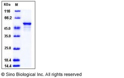 Sino Biological Human DOT1L / KMT4 Protein 50ug, Quantity: Each of 1