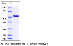 Sino Biological Human ENO1 / Enolase 1 / alpha-enolase Protein (His Tag)