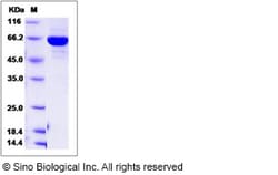 Sino Biological Recombinant Human PTPN12 Protein (aa 1-355, His & GST Tag),