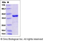 Sino Biological Recombinant Human PTPN12 Protein, Quantity: Each of 1