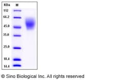 Sino Biological Recombinant Human B7-H2/ICOSLG Protein (ECD, His Tag),