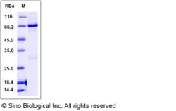 Sino Biological Recombinant Human NLK/Nemo Like Kinase Protein (His & GST