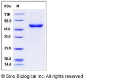 Sino Biological Human EDAR / DL Protein (Fc Tag) 100ug, Quantity: Each