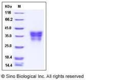 Sino Biological Recombinant Human EDAR Protein (His Tag), Quantity: Each