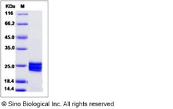 Sino Biological Human ESM1 / Endocan Protein (His Tag) 100ug, Quantity: