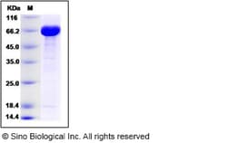 Sino Biological E. coil Bifunctional protein BirA (His & MBP Tag) 100ug,