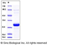 Sino Biological Recombinant Human SNAP-25 Protein (His Tag), Quantity:
