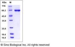 Sino Biological Recombinant Human STK40 Protein (His & GST Tag), Quantity:
