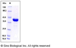 Sino Biological Human AKR1A1 Protein (His Tag) 100ug, Quantity: Each of