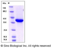 Sino Biological Human NRG1-beta 1 Protein (ECD, Fc Tag) 100ug, Quantity: