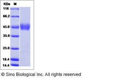 Sino Biological Human NRG1-beta 1 Protein (ECD) 1mg, Quantity: Each of