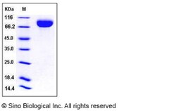 Sino Biological Human CD111 / Nectin-1 / PVRL1 Protein (Fc Tag) 100ug,