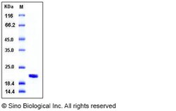 Sino Biological Human NME1 / NDKA Protein (His Tag) 50ug, Quantity: Each