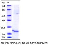 Sino Biological Human Relaxin-1 / RLN1 Protein (His Tag) 50ug, Quantity: