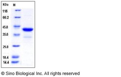 Sino Biological Human PCBP1 Protein (His Tag) 100ug, Quantity: Each of