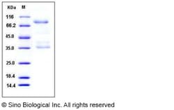 Sino Biological Recombinant Human RAGE Protein (hFc Tag), Quantity: Each