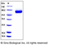Sino Biological Recombinant Human DLL1 Protein (His Tag), HPLC-verified,