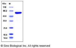 Sino Biological Recombinant Human ALDH1A3 Protein (His Tag), Quantity: