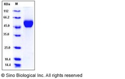 Sino Biological Human Lumican / LUM Protein (His Tag) 100ug, Quantity: