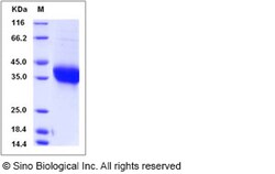 Sino Biological Recombinant Human Adrenomedullin Protein (hFc Tag), HPLC-verified,