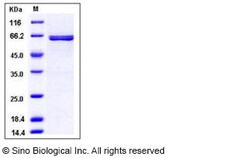 Sino Biological Recombinant Human AIM2 Protein (GST Tag), Quantity: Each