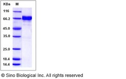 Sino Biological Human EphA7 / EHK3 Protein (His & GST Tag) 50ug, Quantity: