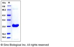 Sino Biological Human UCHL1 / PGP9.5 Protein (His Tag) 50ug, Quantity: