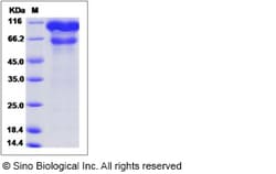 Sino Biological Human LOXL2 / Lysyl oxidase homolog 2 Protein (His Tag)