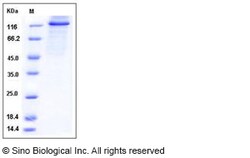 Sino Biological Recombinant Human Protein Kinase D2/PRKD2 Protein (His