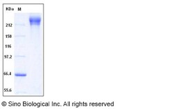 Sino Biological HIV-1 gp140 Protein (group M, subtype CRF07_BC) (Fc Tag),