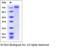 Sino Biological HIV-1 gp140 Protein (group M, subtype CRF07_BC) (His Tag),
