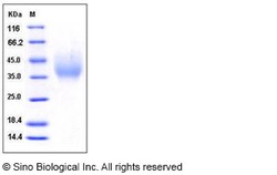 Sino Biological Recombinant Human DMBT1 Protein (His Tag), Quantity: Each