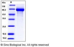 Sino Biological Influenza A H1N1 (A/Puerto Rico/8/1934) Hemagglutinin Protein