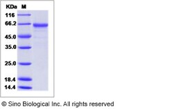 Sino Biological Influenza A H1N3 (A/duck/NZL/160/1976) Hemagglutinin /
