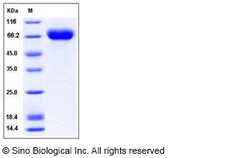 Sino Biological Influenza A H1N3 (A/duck/NZL/160/1976) Hemagglutinin /